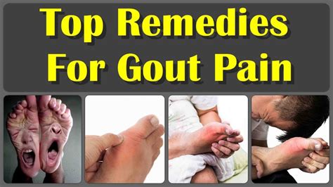 how to cure gout immediately.